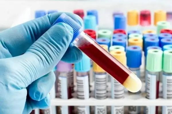 شرح وظایف فلبوتومیست