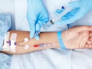 فرق آنژیوکت با اسکالپ