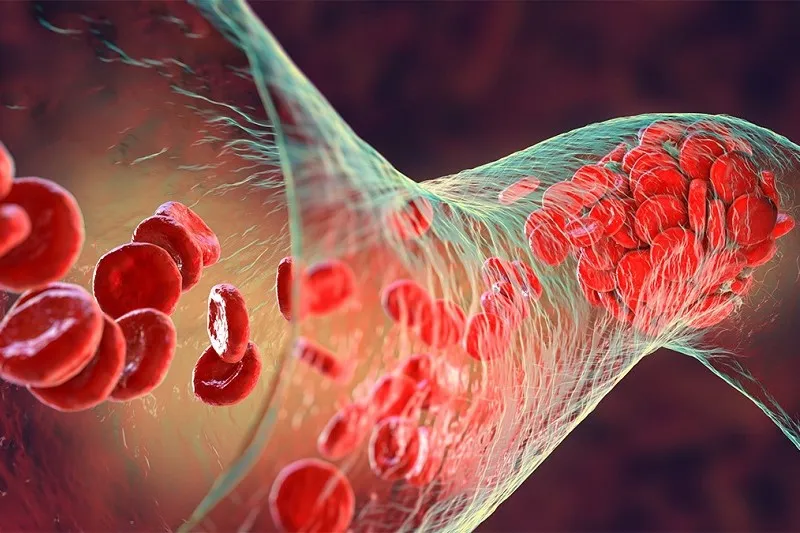 Symptoms of thick blood during pregnancy