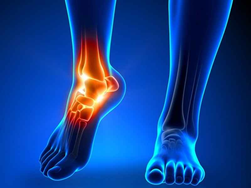 روش‌های مدیریت درد پاشنه ناشی از کم‌خونی