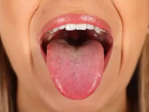 کمبود آهن و ویتامین b12 و گلوسیت