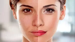 ویتامین برای سفید شدن پوست