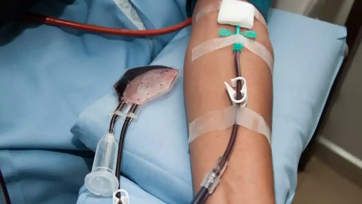 فلبوتومی چیست و چگونه عمل می‌کند؟