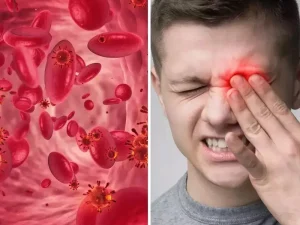 چه ارتباطی بین سردردهای میگرنی و کم‌خونی وجود دارد؟