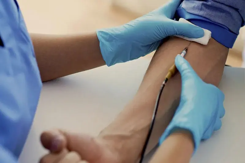 سم زدایی خون از استروئید و فلبوتومی