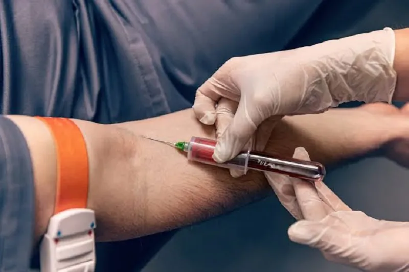 How to perform the MCHC test