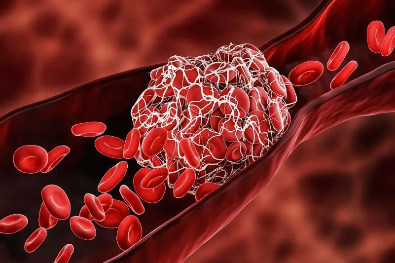 What is blood viscosity and why does it occur