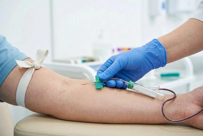 phlebotomy